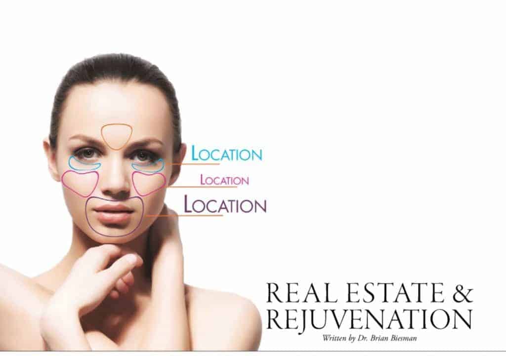 Picture of a woman with different areas of the face outlined for rejuvenation